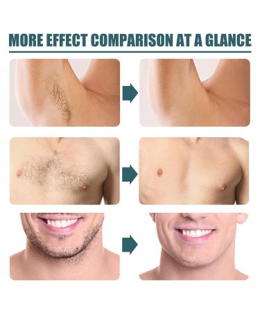 Easy to Apply Men's Hair Removal Cream | Painless Conditioning & Suitable for All Skin Types - International Shipping Available - Buy Online on GoSupps.com