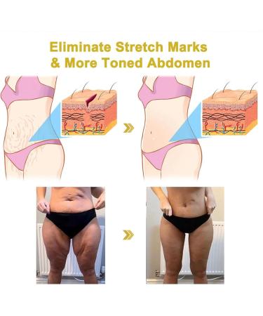 Coolord Luxury Collagen Firming Cream Collagen Lotion to Tighten Body Skin Stimulates Skin's Moisturizing Barrier and Gives Radiant Skin 24 Hours for All (3pcs) - Buy Online on GoSupps.com