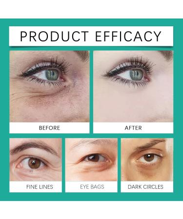 Instant Anti Dark Circles and Wrinkles Cream Eye Contour Cream Aging Eye Cream Eye Lift Serum Dark Circles Eye Cream Eye Cream Against Dark Circles and Bags (2PC) - Buy Online on GoSupps.com