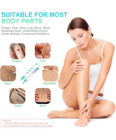 New Version Auto Skin Tag Remover Kit 2-Set Painless Skin Tag Removal Kit Tools for (1-9mm) Skin Tags (includes 100 Removal Bands & 36 Repair Patches & 20 Pcs Cleansing Wipes) Blue Green 2pcs Kit - Buy Online on GoSupps.com