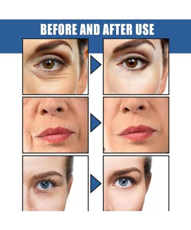 Cr me Instant Lift Plus Anti-Rides Retinol Creme Hydratante Visage Creme Anti Rides Instant Femme Cr me Hydratante Visage Nuit Bio Avec R tinol Anti Ride Puissant Immediat Cremes Wrinkle Power - Buy Online on GoSupps.com