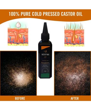 Mekfiwi Jamaican Black Castor Oil - For Hair Skin & Scalp Nourishment 4oz (ricinus communis) - Buy Online on GoSupps.com