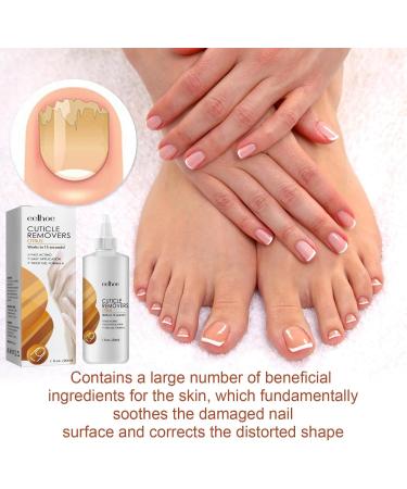 Cuticle Remover Cream Nail Cuticle Remover Gel Cuticle Oil for Nails Cuticle Care Gel Cuticle Remover Liquid Nail Treatments Cuticle Softener and Remover Nail Oil Cuticle Pen Instant Cuticle Remover - Buy Online on GoSupps.com