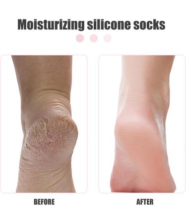Silicone Moisturizing Socks 1 Pair Long Soft Gel Socks Anti Slip Women Foot Mask Socks Spa Pedicure for Dry Cracked Feet Softening Calluses Rough Skin S Silicone Moisturizing Socks Style 2 - Buy Online on GoSupps.com