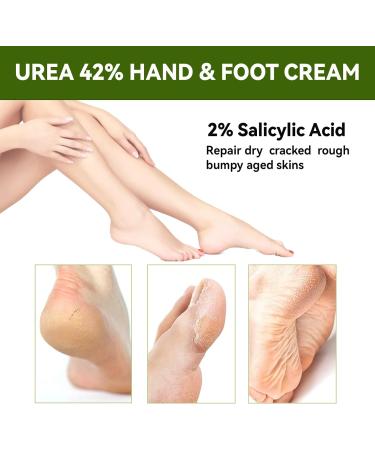 42% Urea Cream with 2% Salicylic Acid Urea Hand Cream for Dry Cracked Skin Repairs Rough Feet & Hands Moisturizes with Coconut & Aloe 50g - Buy Online on GoSupps.com