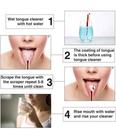 Filowa Stainless Steel Tongue Cleaner Set - 3 Rustproof Tongue Scrapers & Carrying Bag | Effective Bad Breath Solution for Adults & Children - Elegant Rose Gold Finish - Buy Online on GoSupps.com