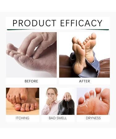 VKaoess Orange Oil Foot Peeling Spray Moisturizing exfoliating spray for dry cracked heels and calluses dead skin cell care tea tree refreshment all skin types 6 bottles - Buy Online on GoSupps.com