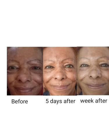 Best Advanced Anti-aging Face Brightener Organic Antiwinkles Acetyl-Glucosamine Serum + vitamin B3 (Niacinamide) Efficient Anti-aging Face Faster Wrinkle reduction Re-activate skin Youth (30 ml) - Buy Online on GoSupps.com