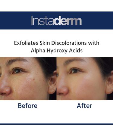 Glycolic Acid 15% Anti-Aging Cream | Exfoliating Facial Moisturizer for Fine Lines Wrinkles & Dark Spots - Buy Online on GoSupps.com