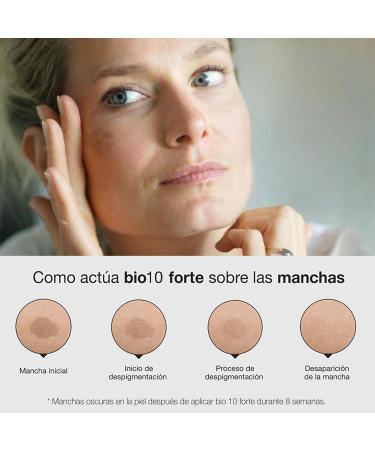 Bella Aurora | Intensive Anti-Depigmentation Treatment M-LASMA | Hormones | 30ml | Hormonal Anti-Dark Spot Cream | Anti-Imperfections Skin Care | BIO10 FORTE M-LASMA - Buy Online on GoSupps.com