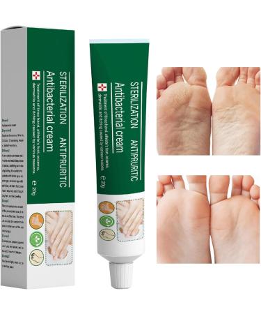  YNPQTDS Foot Repair Cream Nourishing Moisturizing Balm 20g - Hand Lotion - For Sensitive Feet Chapped Skin Daily Use Shower Women Men - Buy Online on GoSupps.com