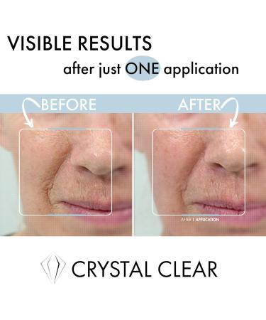 Crystal Clear Skincare 2 Percent Pharma Grade Hyaluronic Serum 30ml - Buy Online on GoSupps.com