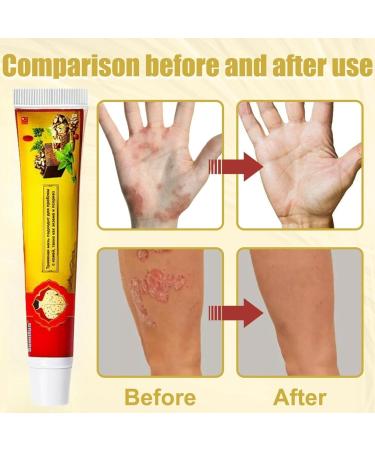 Face Cream Body Cream Anti-Itch Cream Chinese Herbal Cream Skin Repairing Cream for Face Body Healthy Skin Treatment Antifungal Cream Treatment Ointment Cream for Itchy Skin Moisturizing Skin Cream - Buy Online on GoSupps.com