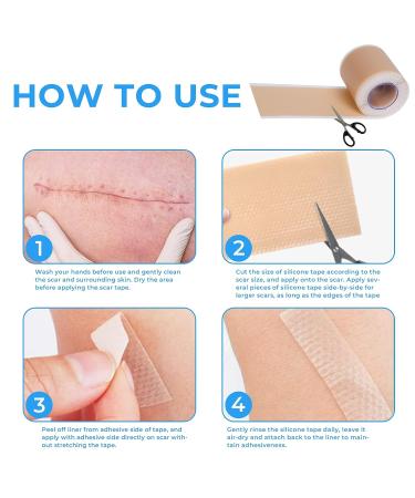 Professional Silicone Scar Sheets Roll - 60 x 1.6 Inches | Reusable Treatment for Keloid, C-Section, Surgery & Acne Scars - Buy Online on GoSupps.com