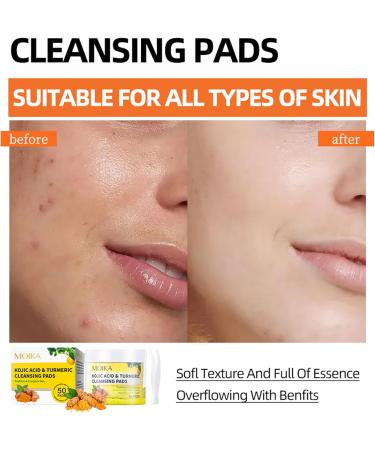 50Pcs Kojic Acid and Turmeric Cleansing Pads Travel-Friendly Cleansing Pads for Gentle Face Cleansing and Skin Smoothing - Buy Online on GoSupps.com