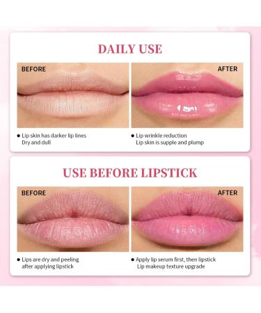  ZHJZGS Pink Lip Serum Color Changing Plumping Glossing Moisturizer Brightening Moisturizer for Dark Lips Glossy Non-Stick Anti-Wrinkle Reduces Fade Lines (2PCS) - Buy Online on GoSupps.com