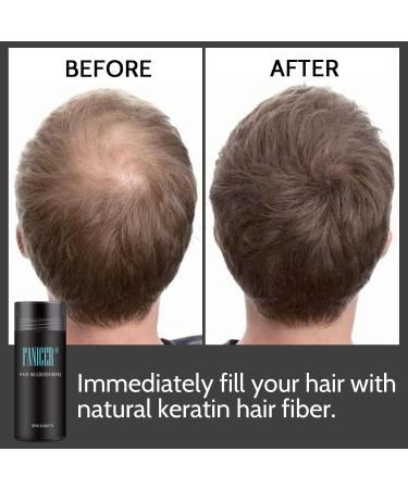 Hair for Hair Thickening Hair Fibres for Hair Thickening Hair Powder for Thin Hair Leave Hair Thicker in Seconds 27.5 g (Dark Brown) - Buy Online on GoSupps.com