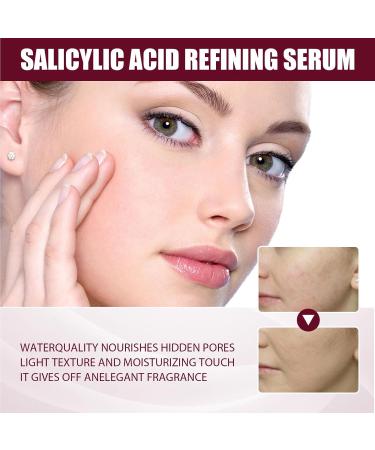 Acid Refining Serum Acid Delicate Essence 2% High-Strength Vitamin Minimises Pore Face Serum Pore Smoothing Fruit Acid Essence - Buy Online on GoSupps.com