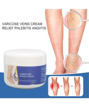 50g Natural Varicose Veins Cream | Leg Circulation & Spider Vein Remover | Cooling Effect | Ointment - Buy Online on GoSupps.com