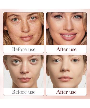 Crsetmyth Drachenblut Creme + Serum Drachenblut face cream Moisture and improvement of dried and rough skin Antiwrinkle face cream Blushing fine lines Punishing & Punishing - Buy Online on GoSupps.com