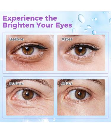 Eye Cream for Dark Circles & Puffiness Revitalizing Formula with Retinol Hyaluronic Acid Caffeine Peptides & Plant Extracts to Smooth Fine Lines 0.53 Fl Oz (Pack of 1) - Buy Online on GoSupps.com