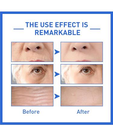 Collagen Anti-Wrinkle Essence Anti-Aging Fading Fine Lines Hydrating Moisturizing Firming Skin Essence 30ml - Buy Online on GoSupps.com