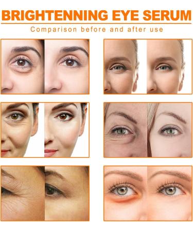 Eye Cream for Dark Circles Wrinkles Eye Bags Vitamin C Anti-Aging Eye Cream Color Corrector to Reduce Fine Lines Wrinkles Dark Circles 20.1 - Buy Online on GoSupps.com