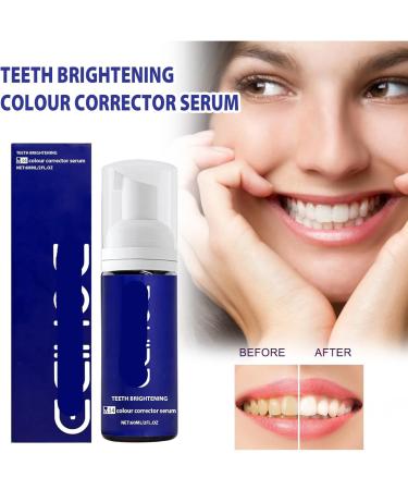 KLYso Activated Charcoal Teeth Whitening & Repair Toothpaste - Stain Removal Gum Care Fresh Breath Oral Hygiene(1PCS) - Buy Online on GoSupps.com