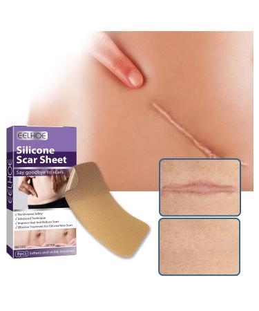 Silicone Fade Stretch Marks and Scars Improving Facial Skin - One Size - Buy Online on GoSupps.com