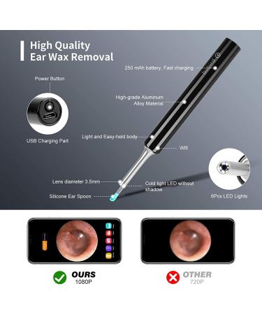 Enjoyee Wireless Ear Wax Removal Kit with 1080P HD Ear Camera for iPhone, iPad & Android - Black - Buy Online on GoSupps.com