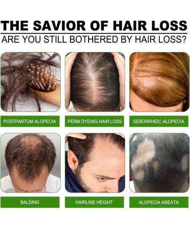 Ginger Hair Oils for Hair Growth - Ginger Hair Growth Serum - Hair Care for Dry Damaged Hair - Moisturize Repair Thin Root Restore Follicles Essence - Strengthen Stimulate Scalp Regrowth Reduce Loss - Buy Online on GoSupps.com