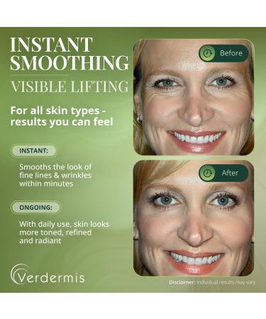 Verdermis Instant Wrinkle Filler for Face Lifting Cream for Eye and Face Lift and Tightening Non-Invasive with Hyaluronic Acid 24k Gold Peptides and Vitamins for Youthful Appearance 1.2 fl oz - Buy Online on GoSupps.com