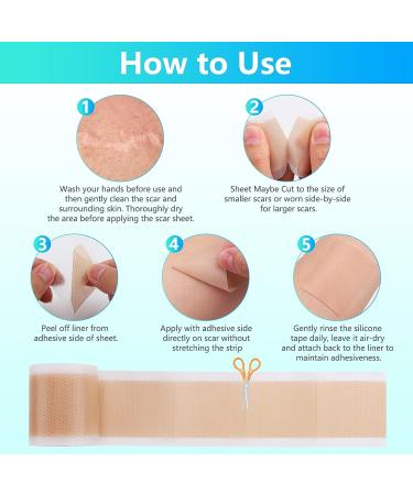 Silicone Scar Sheets 1.6x60 - Reusable & Effective Treatment for C-Section, Burn, Surgery, Acne Scars - Buy Online on GoSupps.com