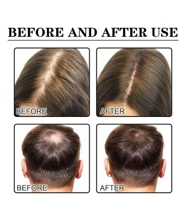 Allurium Hair Growth Serum for Black Women - Fast Natural Hair Growth & Repair - 2023 New Formula - Set of 3 - Buy Online on GoSupps.com