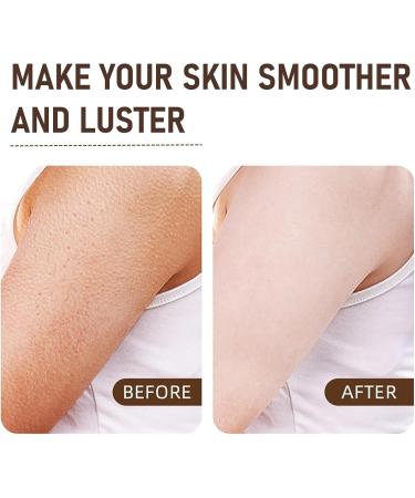 Rice Exfoliator Gel Mild Rice Face Scrub Large Capacity Body Scrub Improve Back Acne Soft Skin&Remove Dead Skin Deep Cleansing Hydrating Scrub Gel Body Exfoliator For Face&Hand Foot & Back 200ml - Buy Online on GoSupps.com
