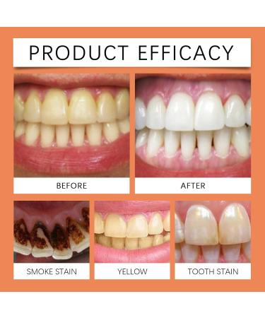 Green Salt Care Toothpaste - Gentle Formula Cleans Teeth Removes Stains Soothes Oral Sensitivity Daily Oral Care(2PCS) - Buy Online on GoSupps.com