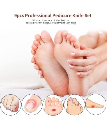Segbeauty 9PCs Professional Pedicure Knife Set - High Manganese Steel Nail Care Tools for Ingrown Nails & Corn Removal - Buy Online on GoSupps.com