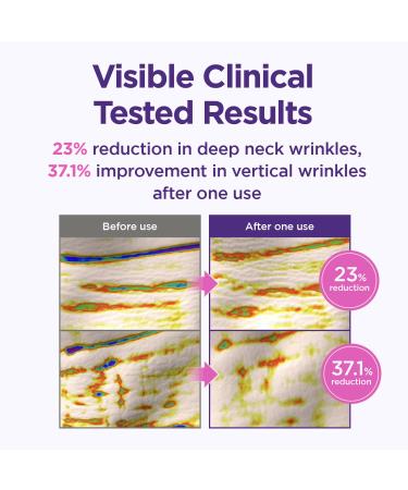 CKD Gua Sha Neck Cream Filltocshot Bundle (1.69 fl oz + Refill 1.69 fl oz) Advanced Retinal & Collagen Anti-Aging Firming with Massage Roller Wrinkle Reduction Lifting & Tightening Korean Skincare - Buy Online on GoSupps.com