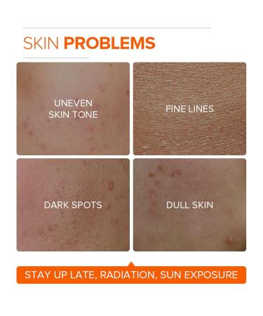 Buy Vitamin C Face Cream - Anti-Aging & Moisturizer for Men & Women | International Shipping - Buy Online on GoSupps.com