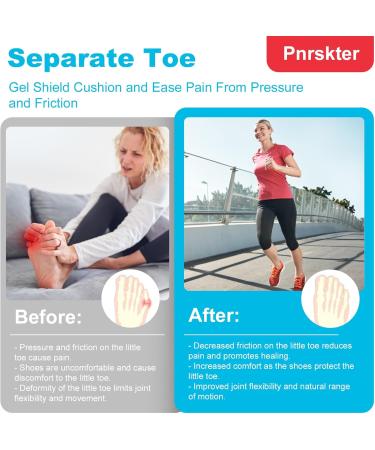 20 Pieces Silicone Toe Protection - Relief for Bubbles Hammer Toes & Friction Pain | EU Size 35-43 - Buy Online on GoSupps.com