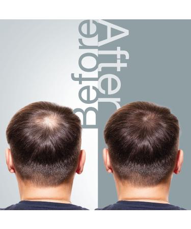 Mossi London Hair Loss Shampoo for Thinning Hair - 6.7 Fl Oz | Hair Growth for All Hair Types - Buy Online on GoSupps.com