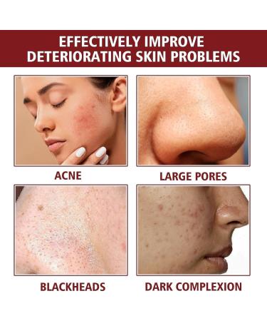 AHA 30% + BHA 2% Peeling Solution Glycolic Acid Peel with Aloe Vera for Large Pores Wrinkles & Fine Lines Chemical Peel for Face at Home 1.0 Floz - Buy Online on GoSupps.com