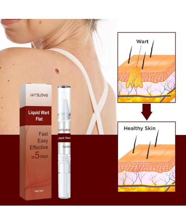 Skin Tag Removal Skin Tag Remover Mole Remover Pen Skin Tag Remover Pen Natural Non-Irritating Skin Tag Remover for All Skin Types - Buy Online on GoSupps.com
