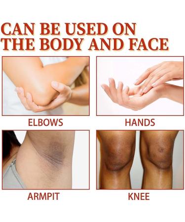 NEUKIN Acantho Clear Therapy Spray - Acanthosis Nigricans Treatment 2Count (Pack of 2) - Buy Online on GoSupps.com