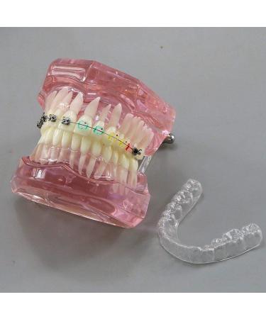 High-Quality Lhlyl-DP Dental Teeth Model for Orthodontic Brackets Simulation | Metal & Ceramic Self-Ligating Bracket Demonstration - Buy Online on GoSupps.com