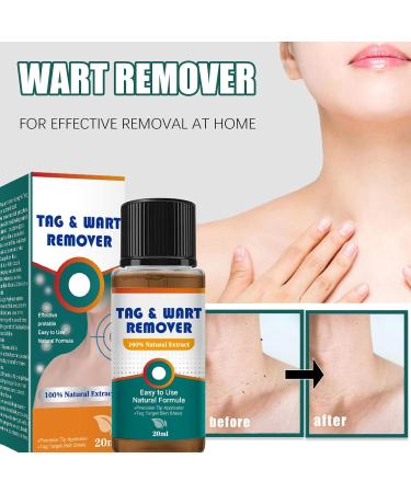 Beauty Grain Corrector | Quick Wart Removal 20ml Blemish Corrector Solution Beauty Home Travel Pre-Event Personal Toiletry Women Men - Buy Online on GoSupps.com