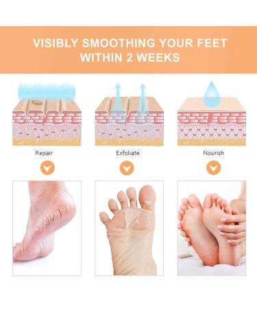 Buy Foot Peeling Mask - Gentle Exfoliating Foot Care for Deep Penetration | Ideal for Women | International Shipping - Buy Online on GoSupps.com