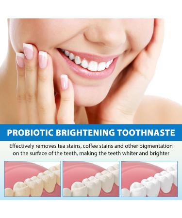 SP-6 Ultra Whitening Toothpaste - Probiotic Brightening & Deep Cleaning Care (2PCS) - International Shipping Available - Buy Online on GoSupps.com