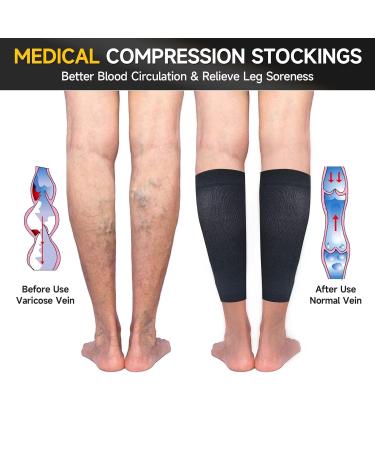 15-20 mmHg Compression Socks for Women & Men | Medical Footless Graduated Stockings for Varicose Veins & Edema | Small Black - Buy Online on GoSupps.com