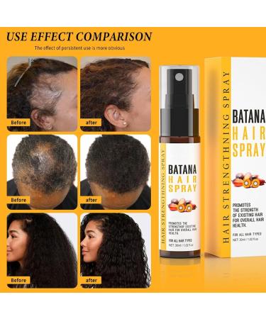 Go Ho Batana Hair Spray Hair Growth Serum Hair Growth Spray Batana Oil Hair Regrowth Care for Thinning Hair Reduce Hair Loss - Buy Online on GoSupps.com